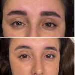 microblading